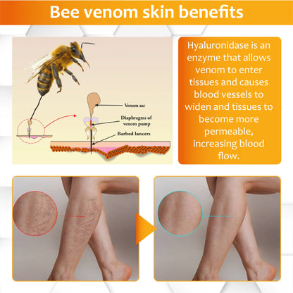 Bee Venom VeinSoothing Cream